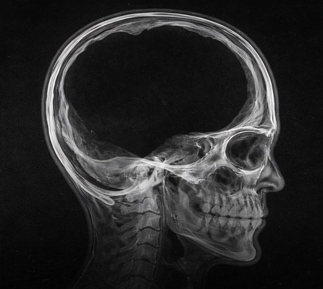 French civil servant brain scan