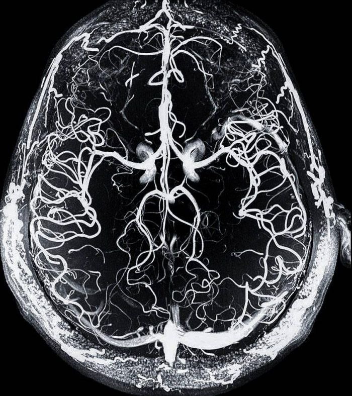 Gratitude rewires the brain neurology