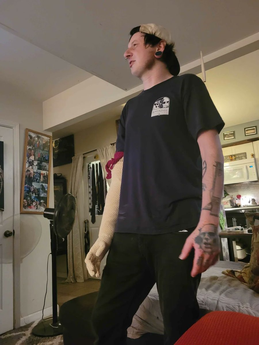 cousin crochets prosthetic arm (photo 2 of 4)