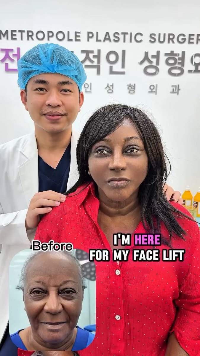 Vietnam woman surgery result METROPOLE PLASTIC SURGERY