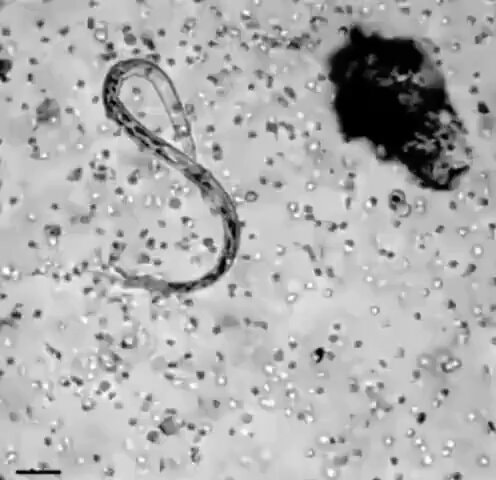 white blood cells attacking a parasite