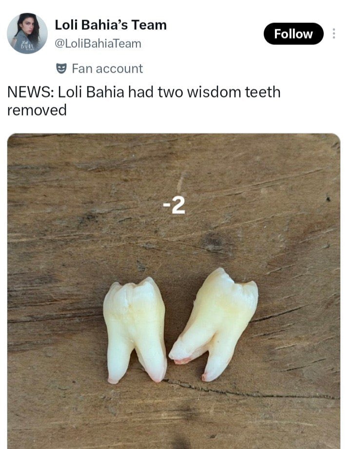 Rosalía Loli Bahia wisdom tooth necklace (photo 2 of 2)
