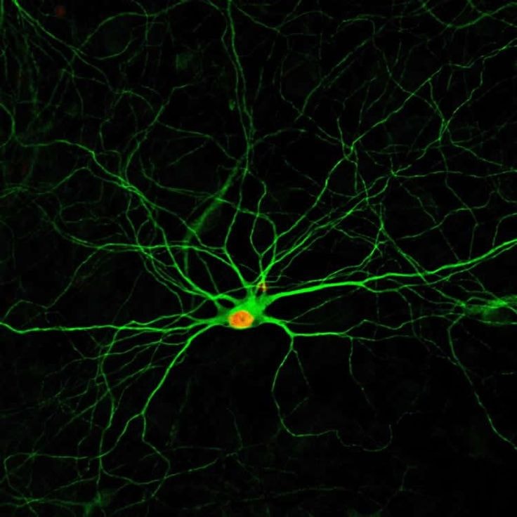 brain and beauty perception (photo 2 of 2)