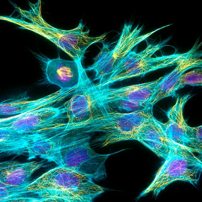quantum brain neurons (photo 2 of 2)