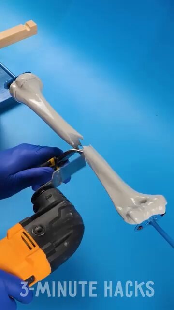 Broken bone repair demo