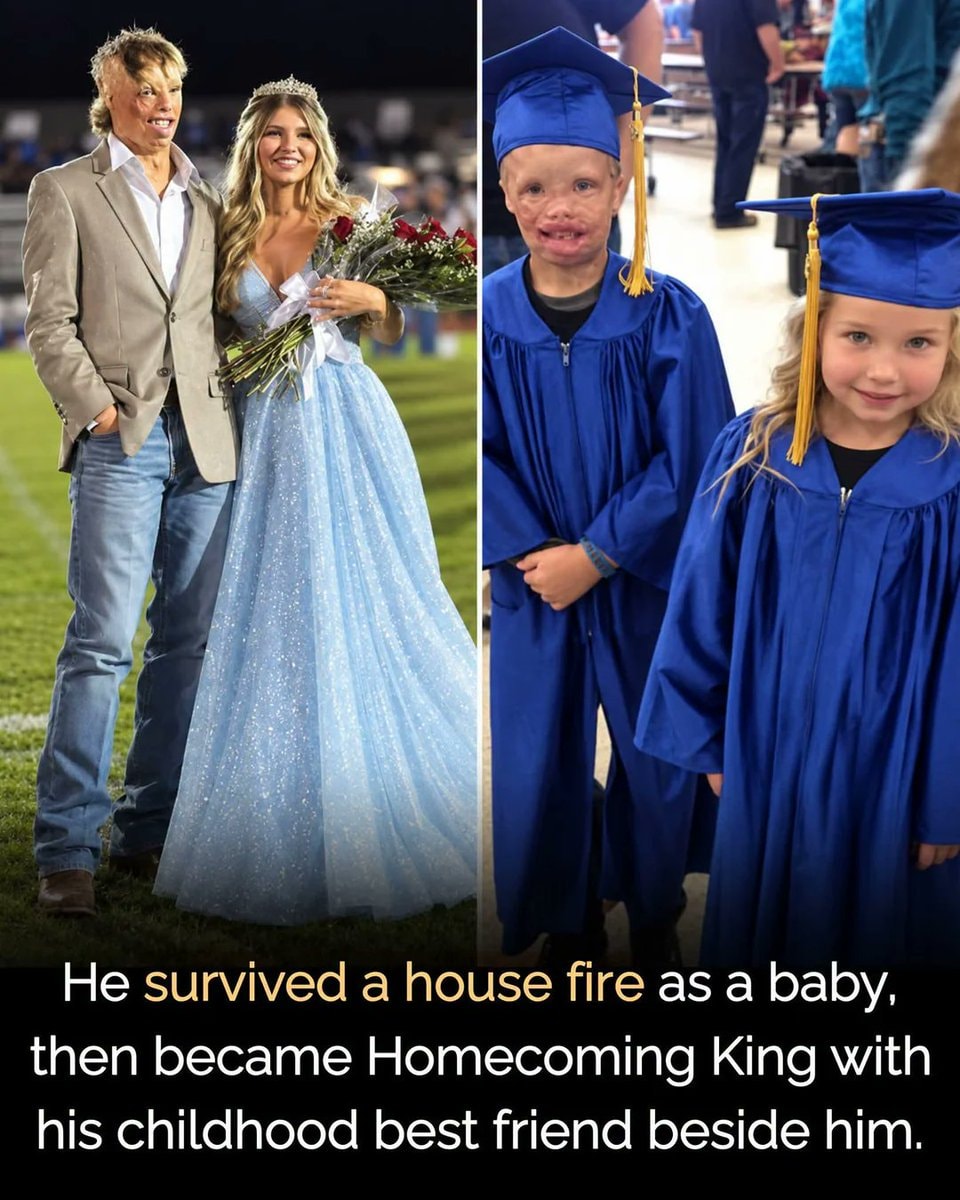 Fire survivor turns into public spotlight