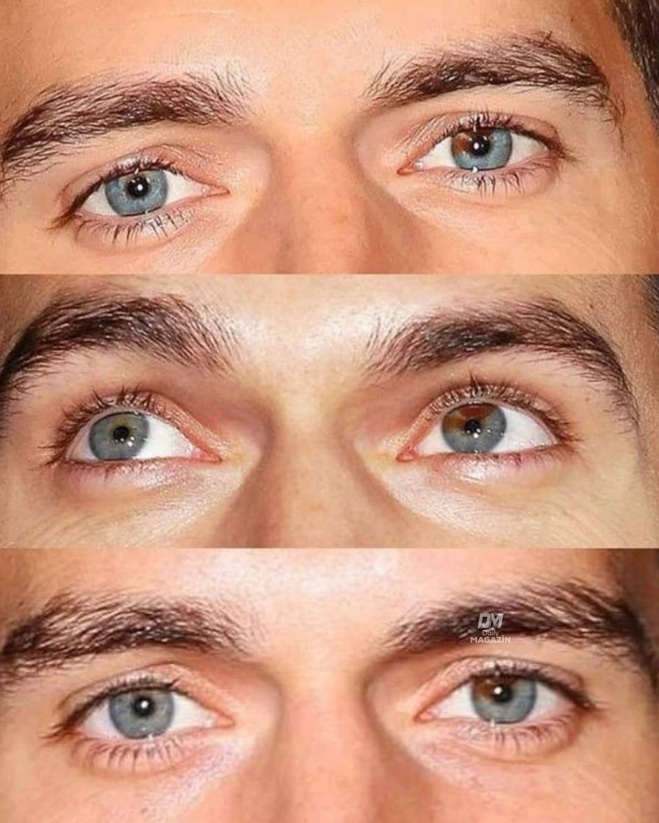 globally recognized eyes