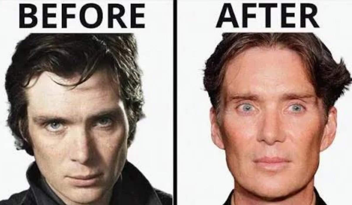 eyelid alteration comparison