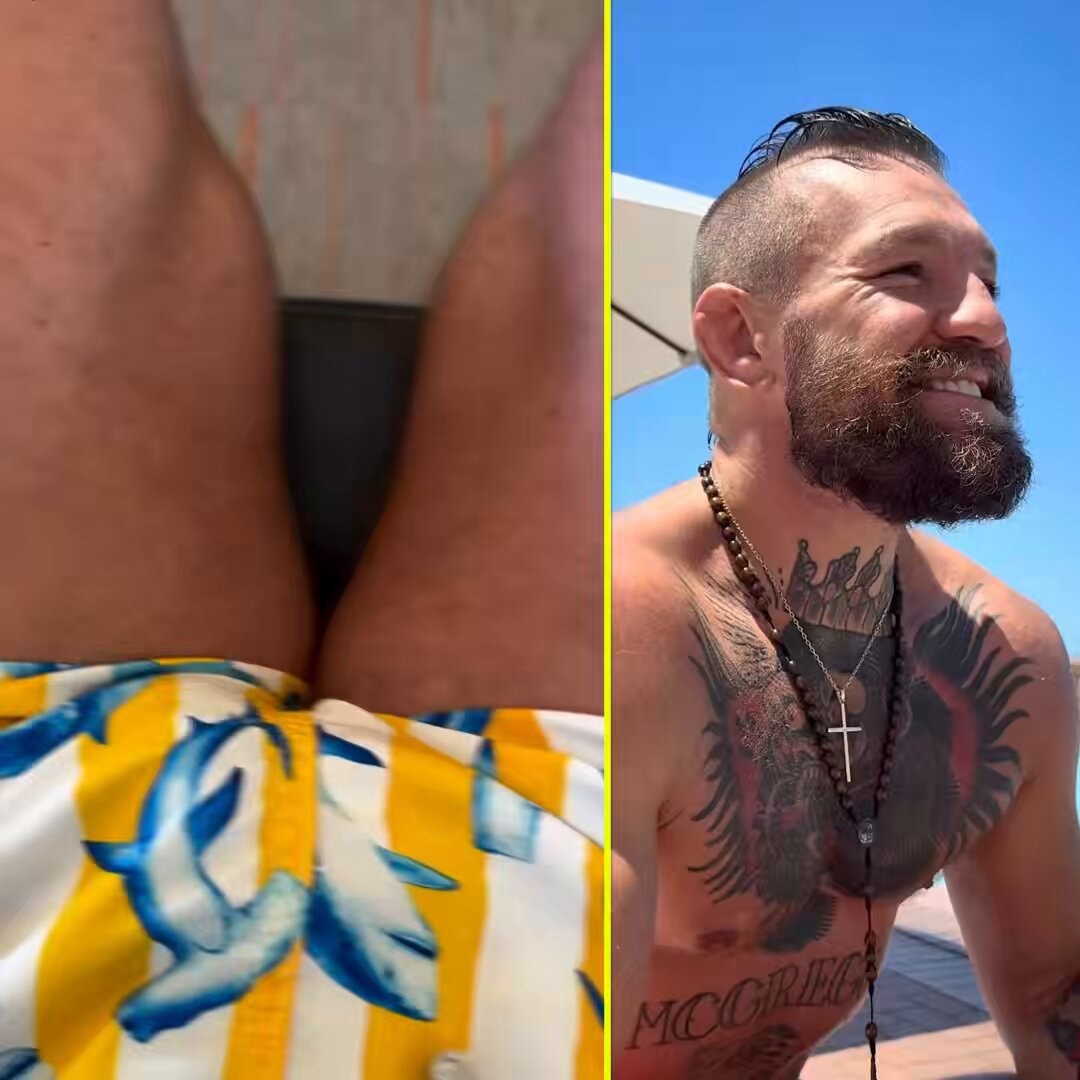 Conor McGregor leg workout ACL meniscus injury