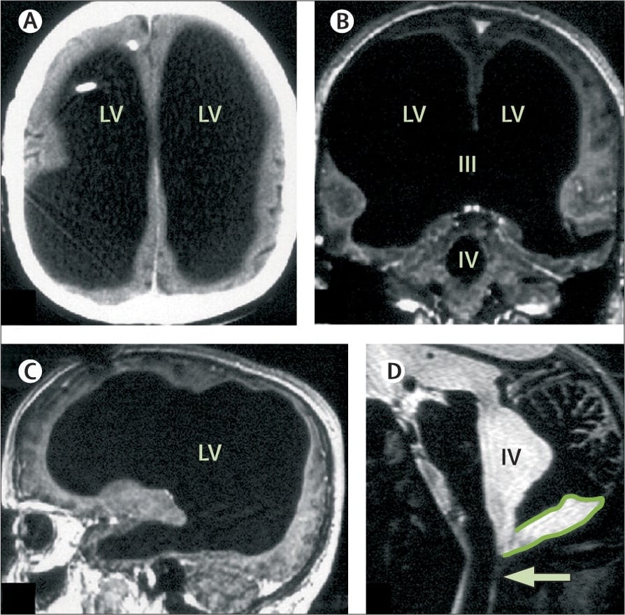 French civil servant brain scan (photo 2 of 2) French civil servant brain scan (photo 2 of 2)