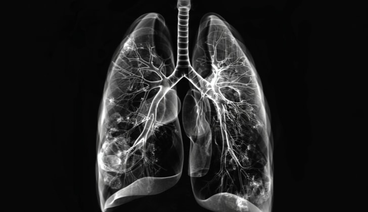 vaping linked to irreversible lung disease (photo 2 of 2)