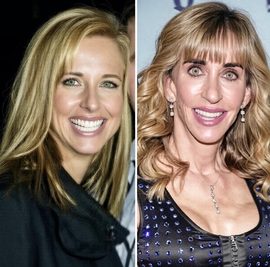 Susan Dell appearance change