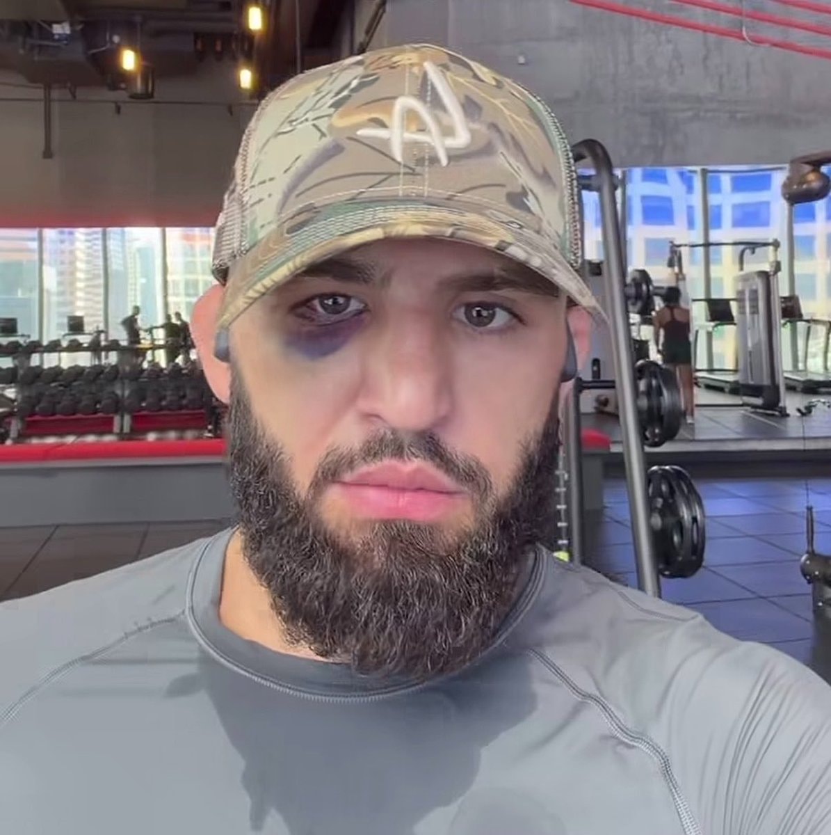 Arman Tsarukyan eye post-UFC331 (photo 2 of 2)