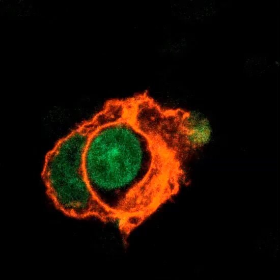 Cancer cells hide from immune attacks
