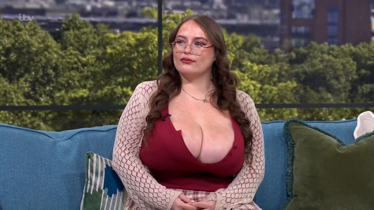 woman with rare breast growth condition