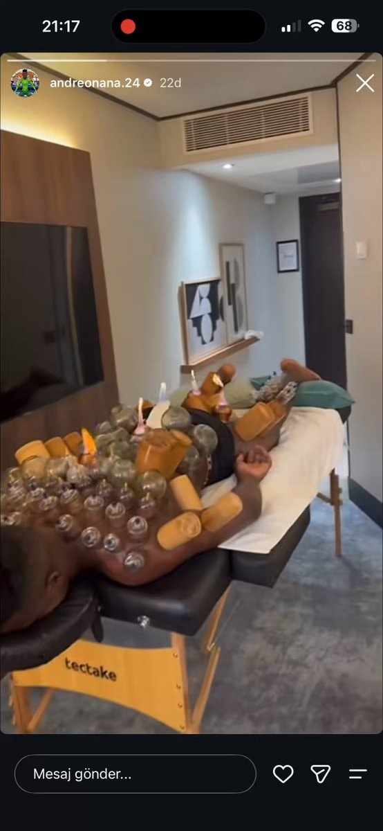 André Onana cupping therapy