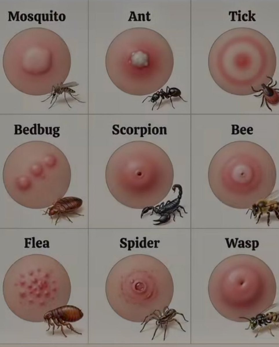 Bug bite identification guide