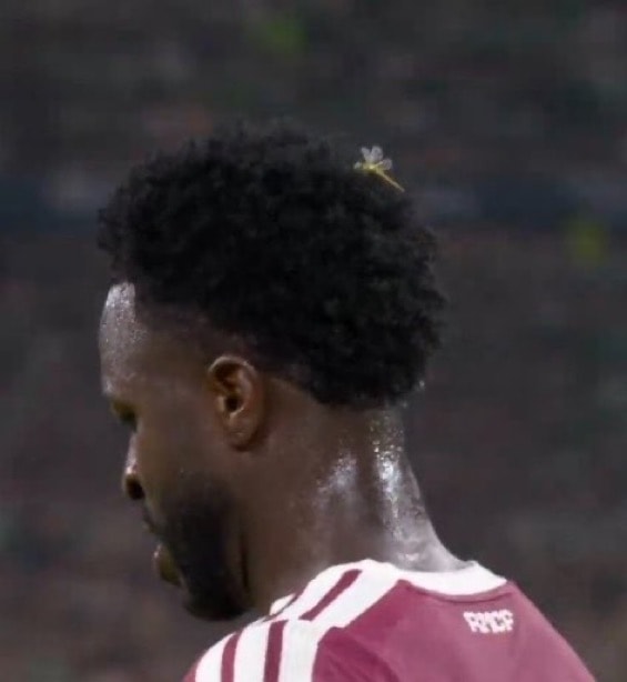 Vinicius match bug (photo 2 of 2)