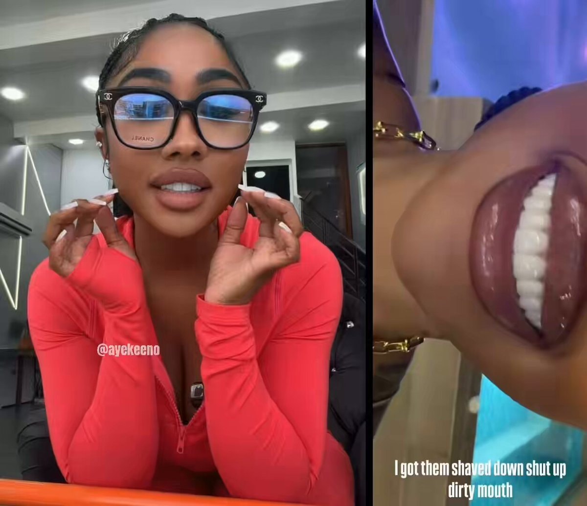 Ari Fletcher new $40,000 teeth Ari Fletcher new $40,000 teeth