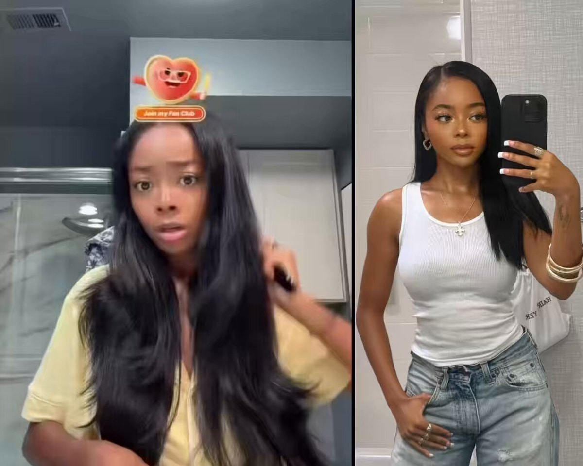 Skai Jackson health update
