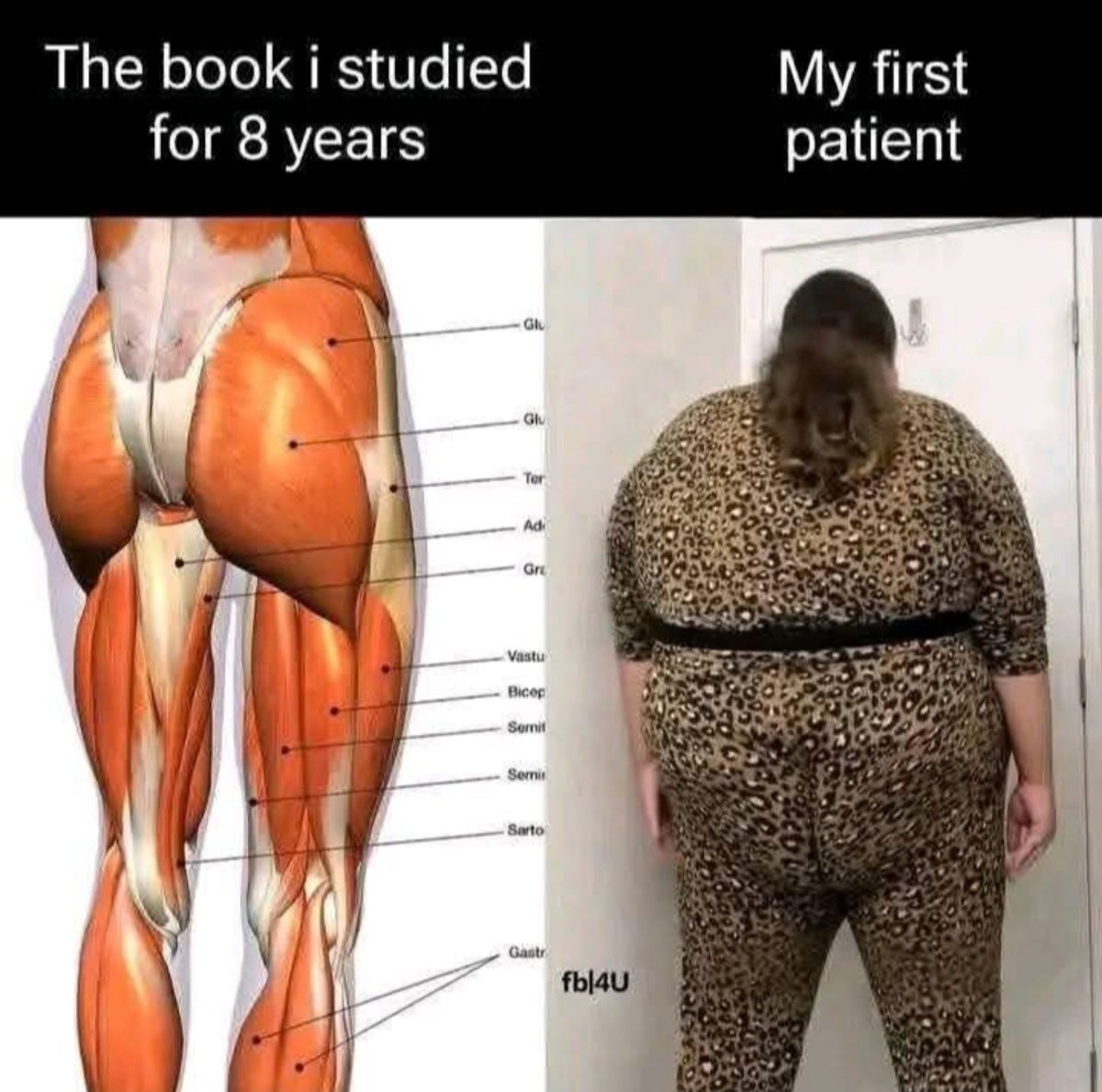 anatomy meme vs real life