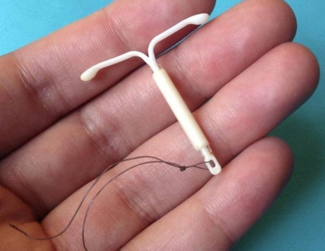 Racist IUDs (photo 2 of 2)