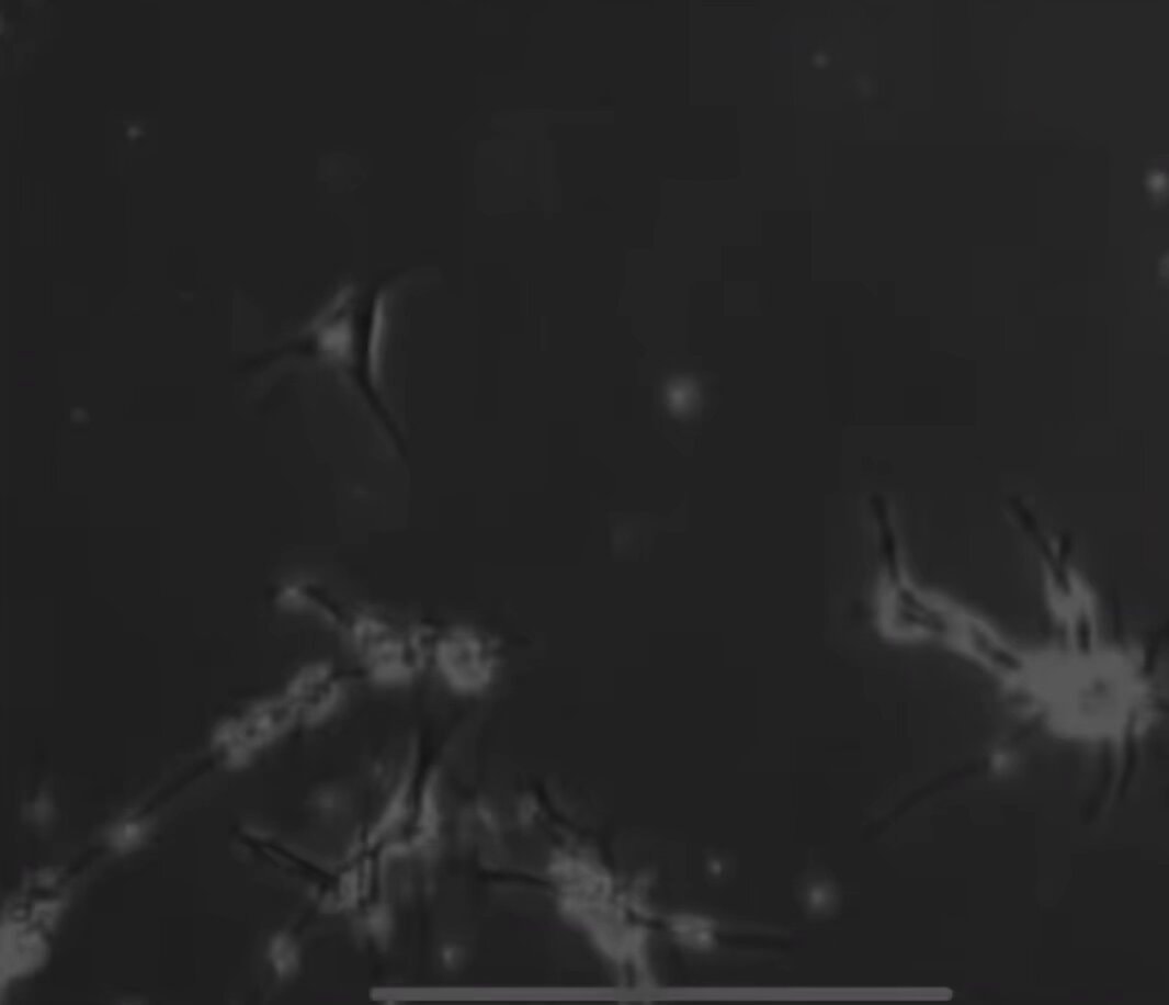 microscopic view of branching cells