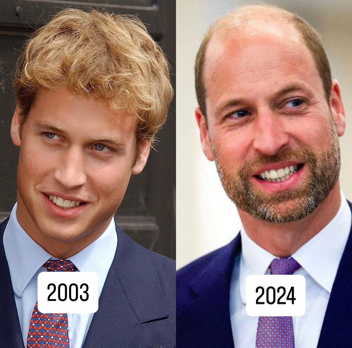Prince William before and after