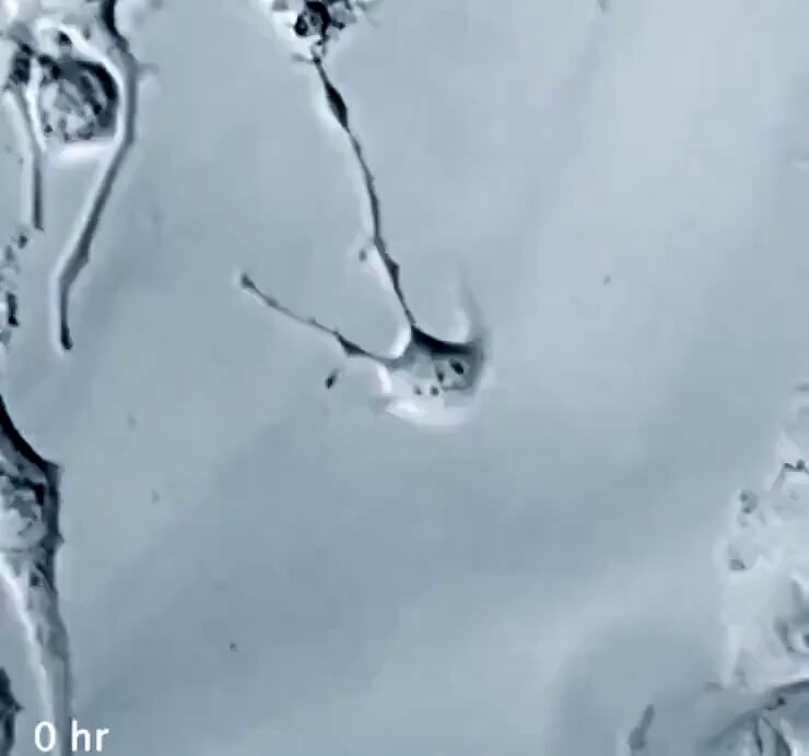 Neuron connecting to other neurons