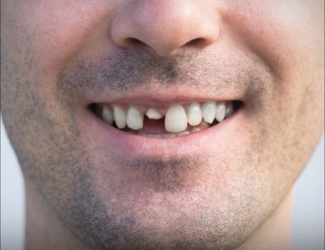 Japan drug to regrow human teeth (photo 2 of 2)