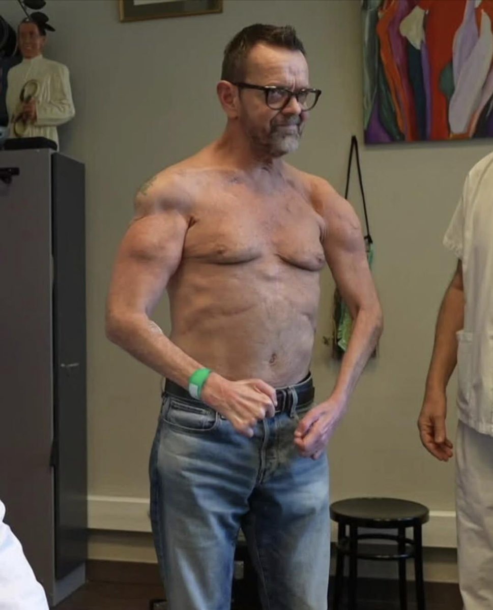 World's First Double Arm And Shoulder Transplant (photo 2 of 3)