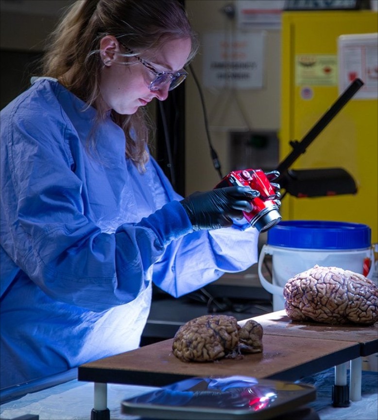 Scientists detach human brain from living body (photo 2 of 2)