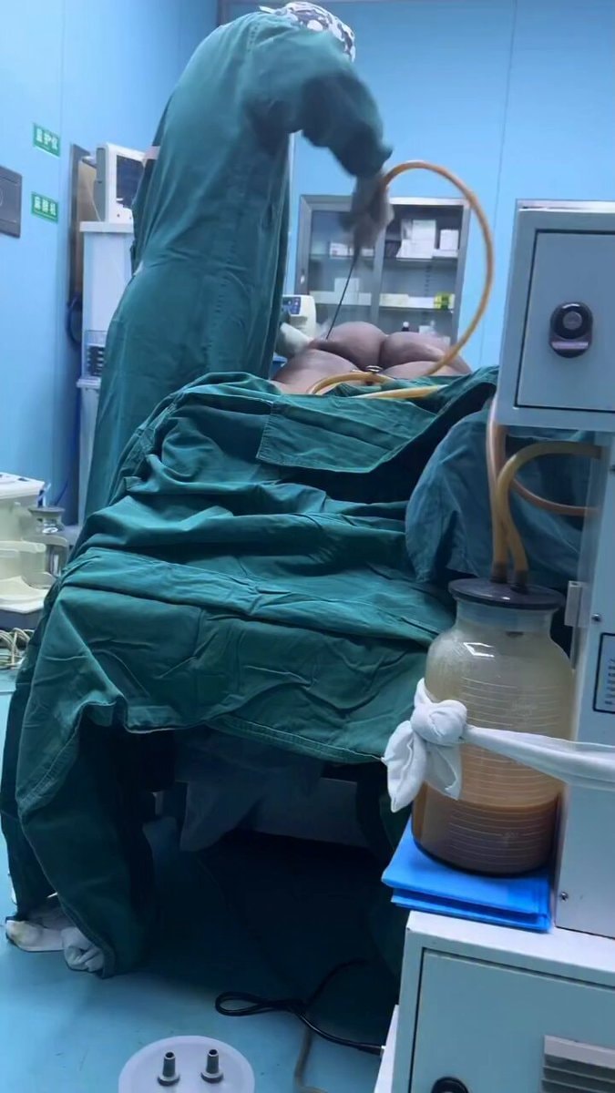 Feminists and BBL procedure