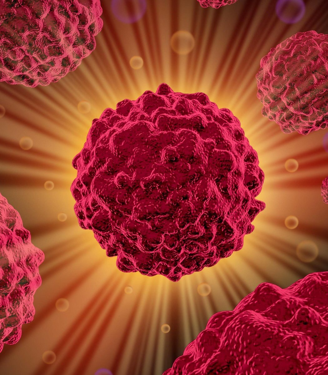 AI detects pancreatic cancer 3 years early (photo 2 of 2)