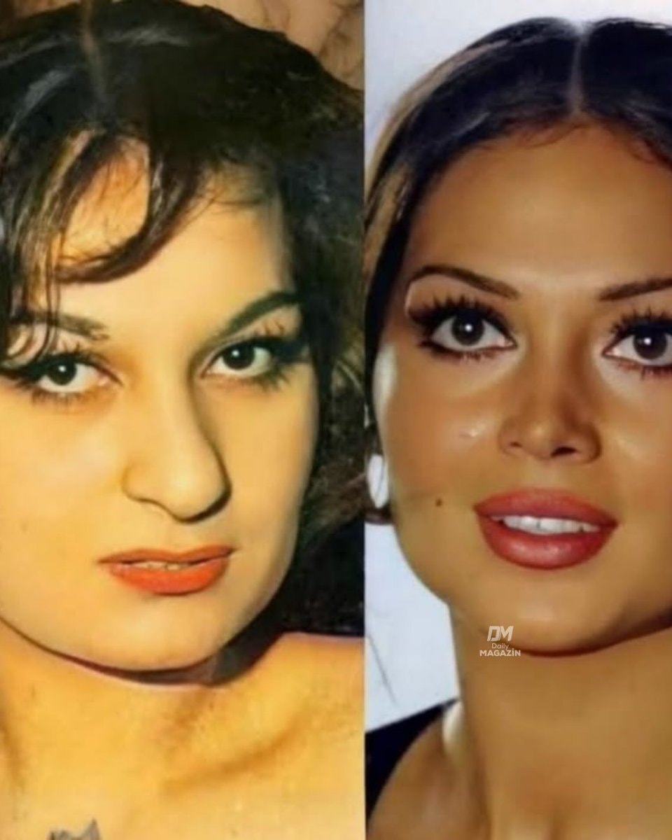 Türkan Şoray transformation