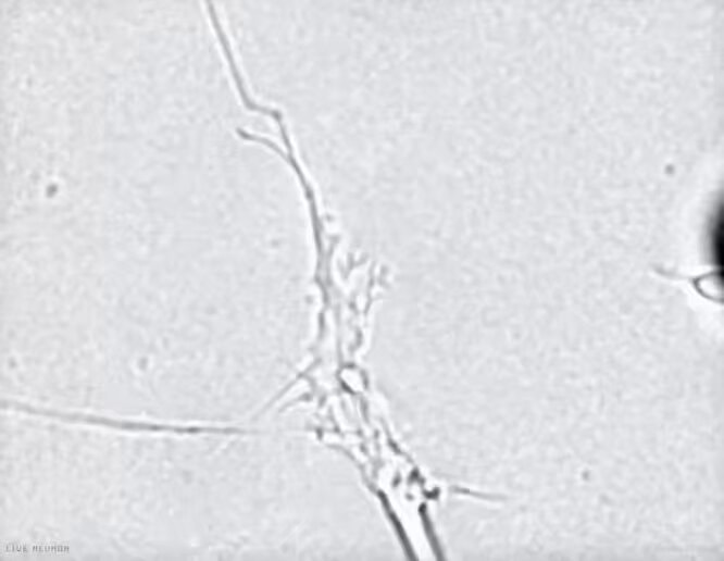Neuron dendrites axon branching documentary footage