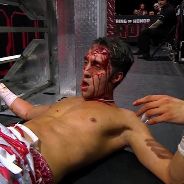 Nick Wayne ROH Blood Incident (photo 1 of 2)