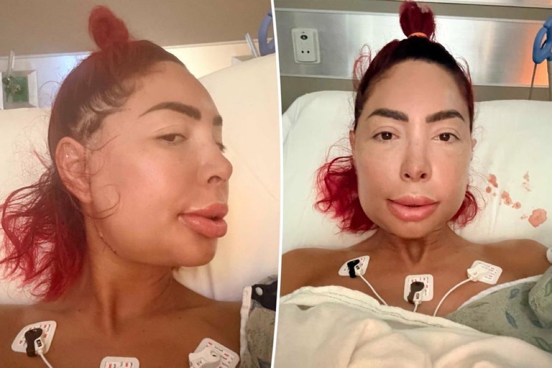 Farrah Abraham jaw surgery Farrah Abraham jaw surgery