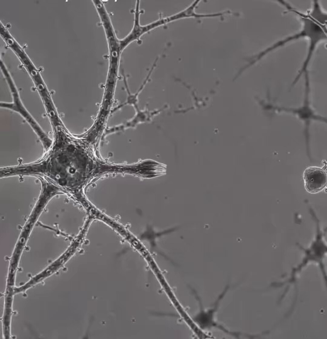 neurons under a microscope