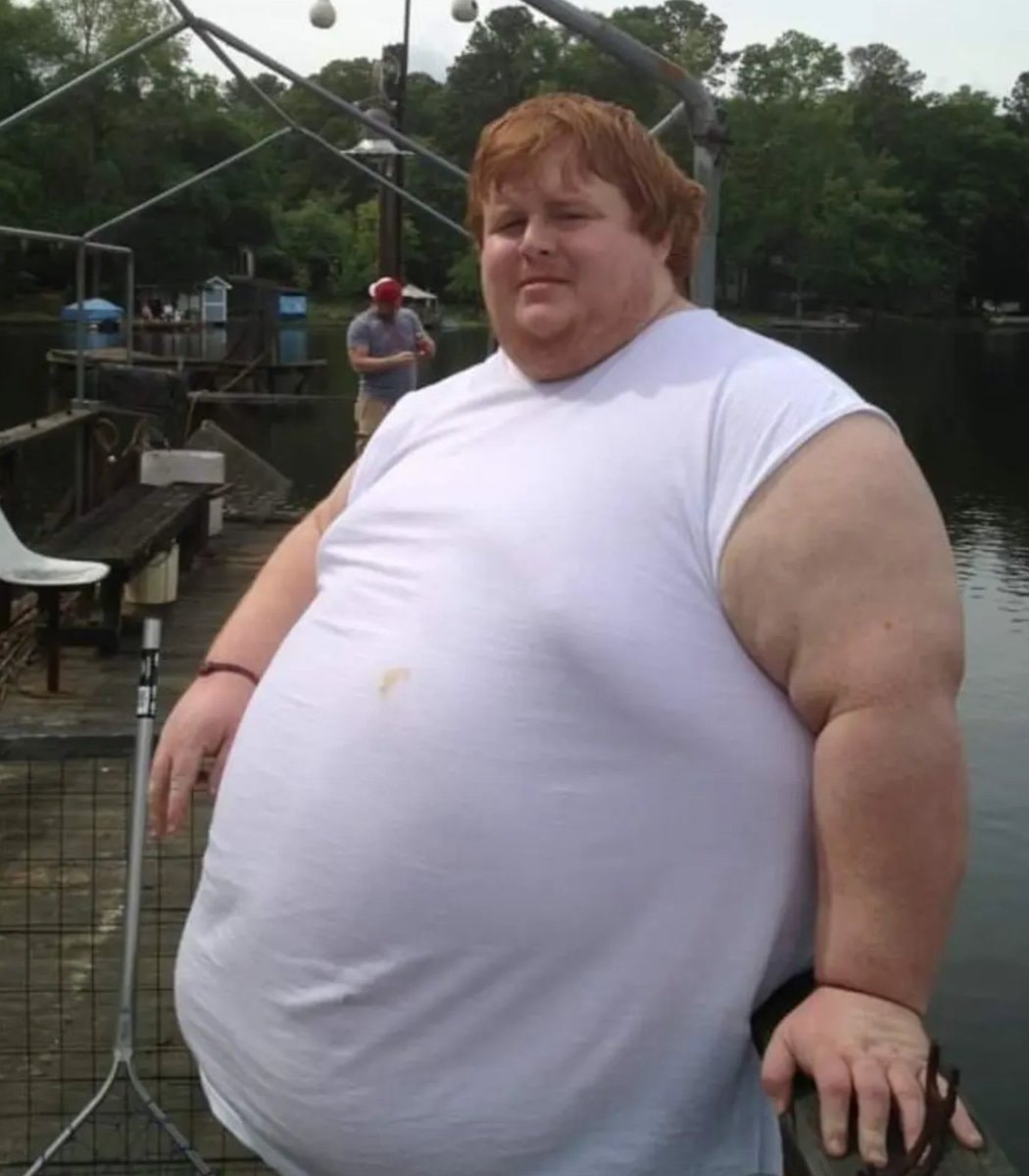 Casey King weight loss update (photo 2 of 2)