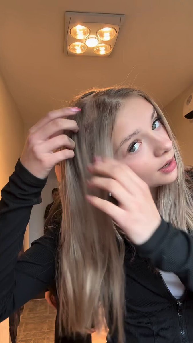 Alopecia diagnosis and shaving her hair