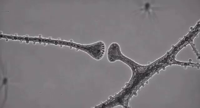 Brain changes from learning and repetition