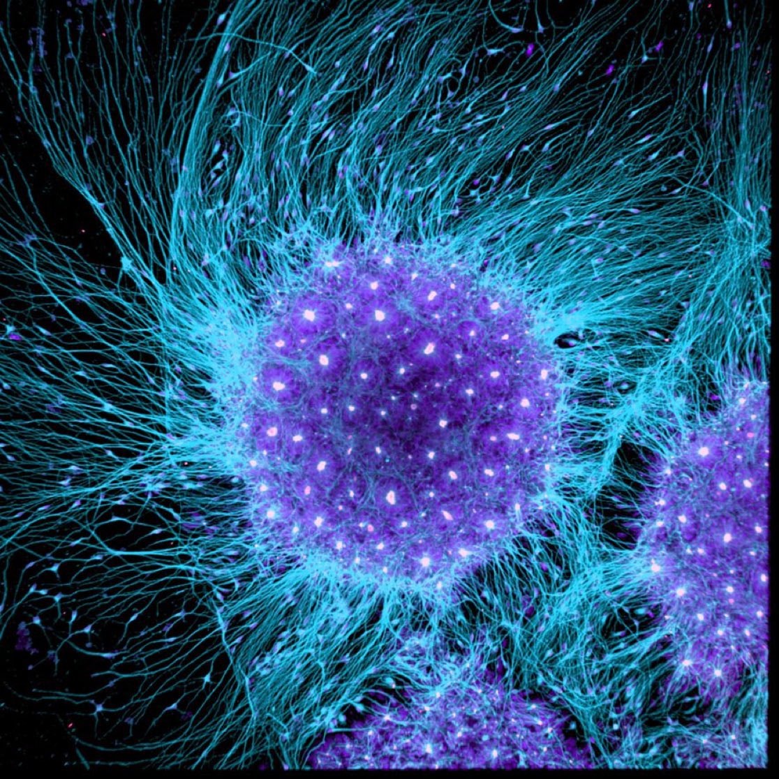 Human brain 86 billion neurons