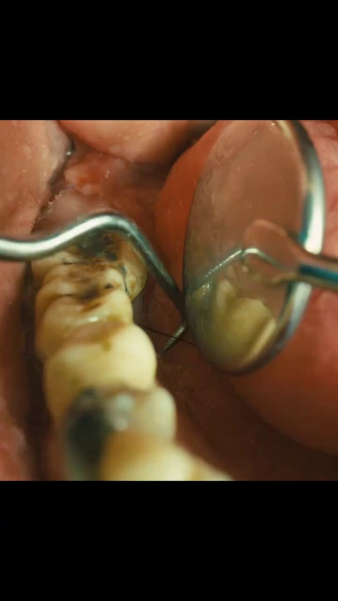 Dental procedure close-up
