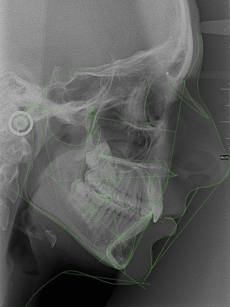 alzheimer's oral cavity study (photo 2 of 2)