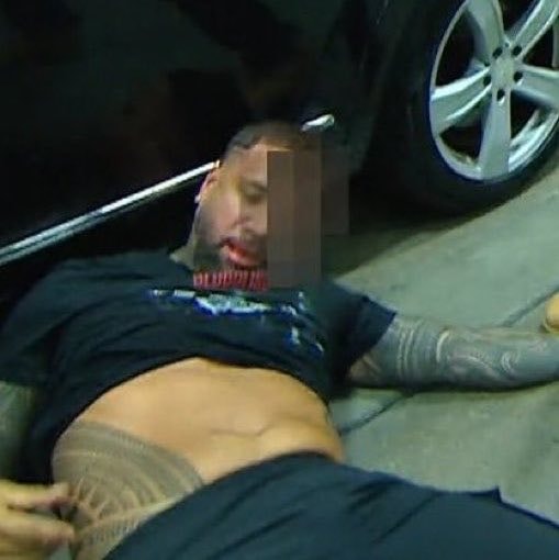 Bloodline member injured WWE