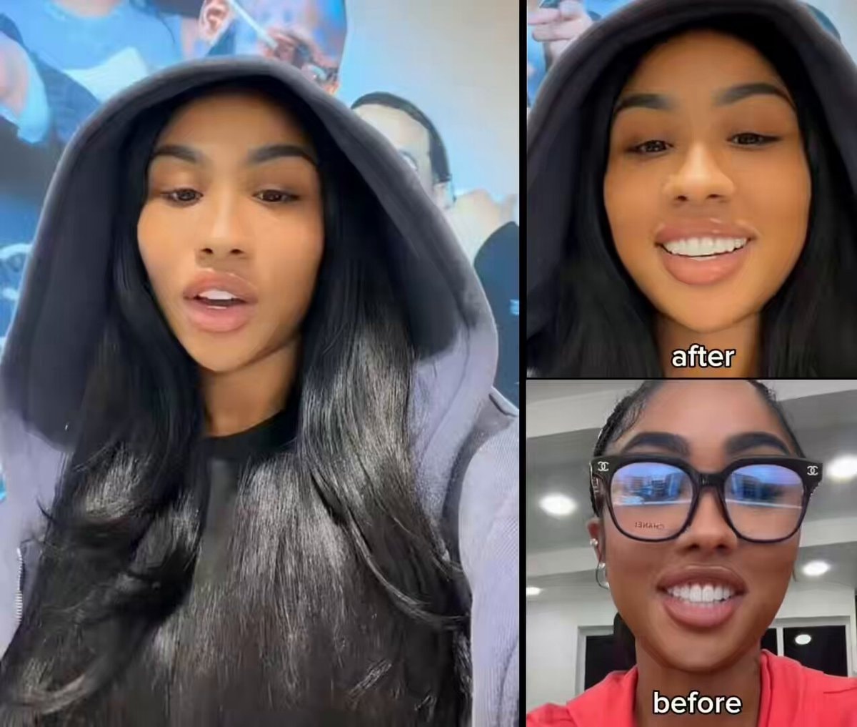 Ari Fletcher new teeth adjustment