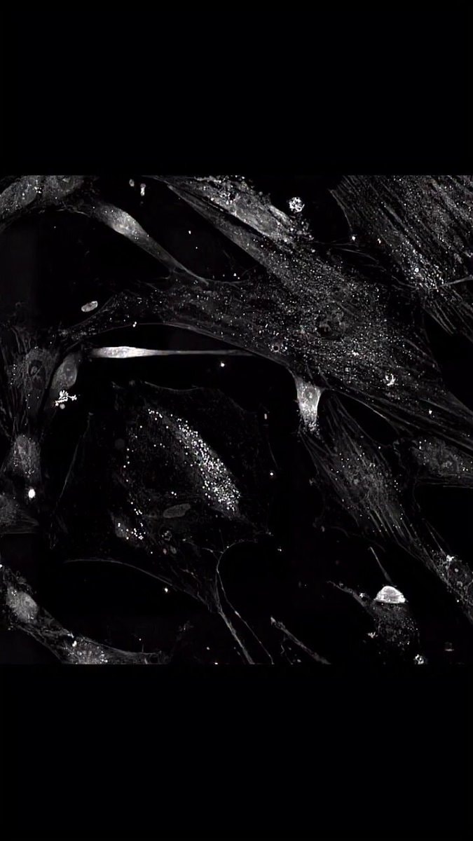 Human stem cells transforming into neurons