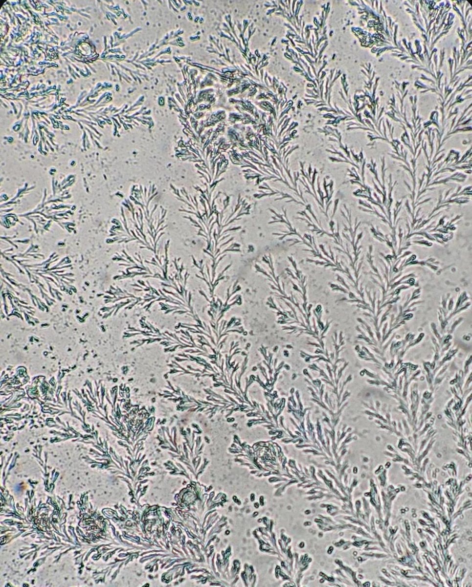 Vaginal secretions microscope view Vaginal secretions microscope view