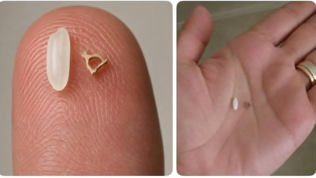 stapes bone size comparison